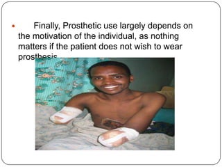 Easy to put on and remove