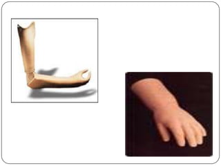 Require only reasonable maintainace.Finally, Prosthetic use largely depends on the motivation of the individual, as nothing matters if the patient does not wish to wear prosthesis.