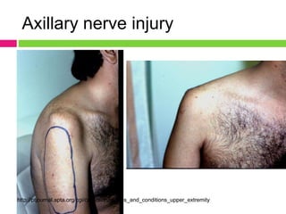 Upper_limb_injuries_x_raysjBqbbsbdhns.ppt