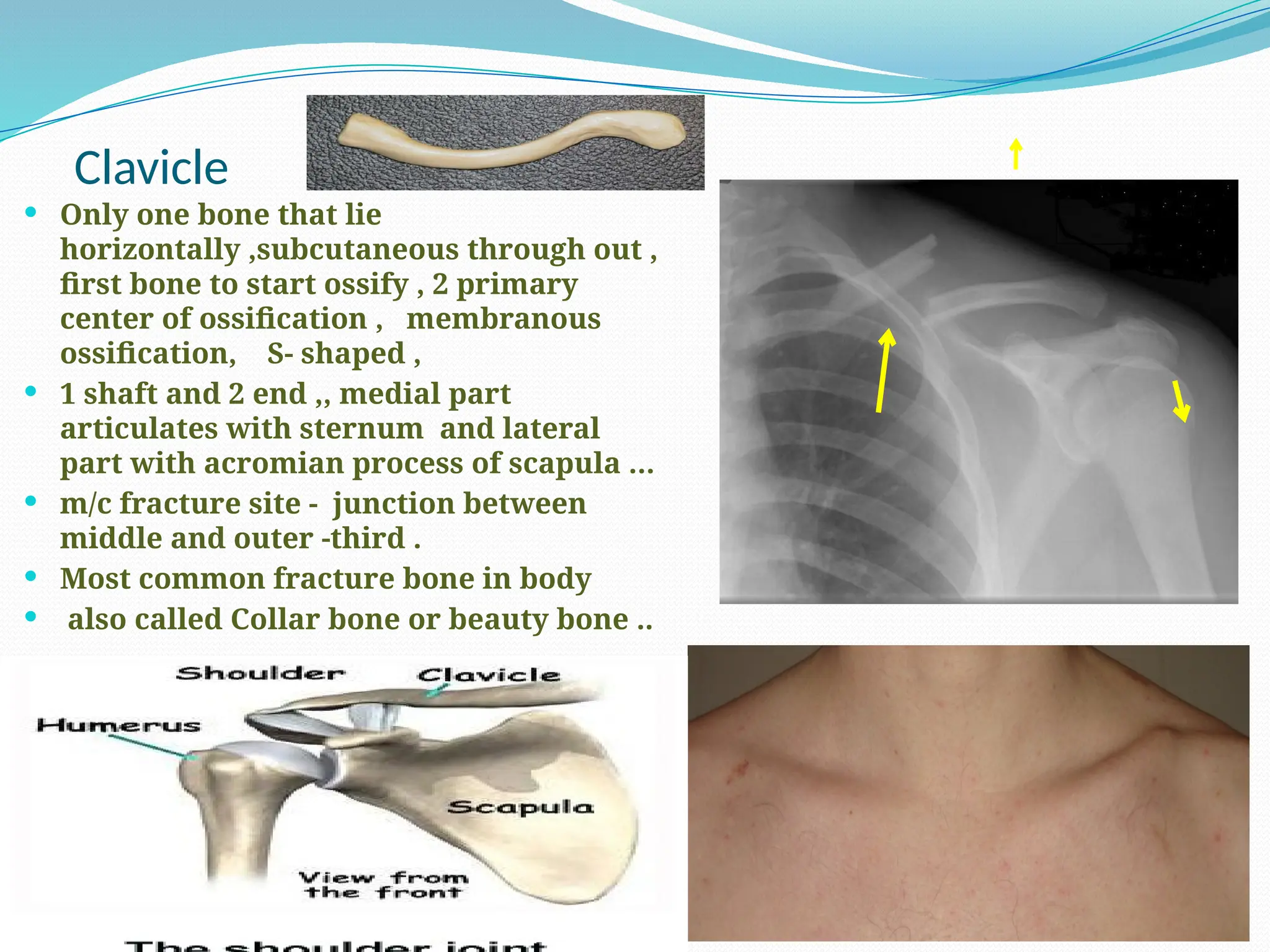 Clavicle
 Only one bone that lie
horizontally ,subcutaneous through out ,
first bone to start ossify , 2 primary
center of ossification , membranous
ossification, S- shaped ,
 1 shaft and 2 end ,, medial part
articulates with sternum and lateral
part with acromian process of scapula …
 m/c fracture site - junction between
middle and outer -third .
 Most common fracture bone in body
 also called Collar bone or beauty bone ..
 