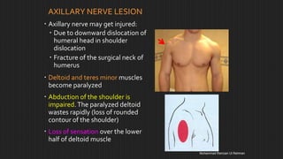 Upper limb nerve injuries | PPT