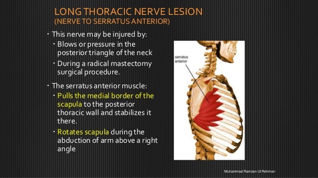 Upper limb nerve injuries