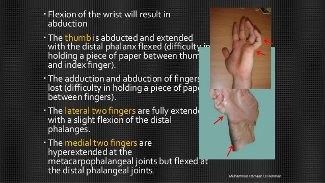Upper limb nerve injuries