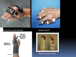 Upper limb orthosis | PPTX