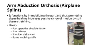 Upper limb Orthosis presentation slide .pptx