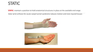 Upper Limb orthotic devices.pptx