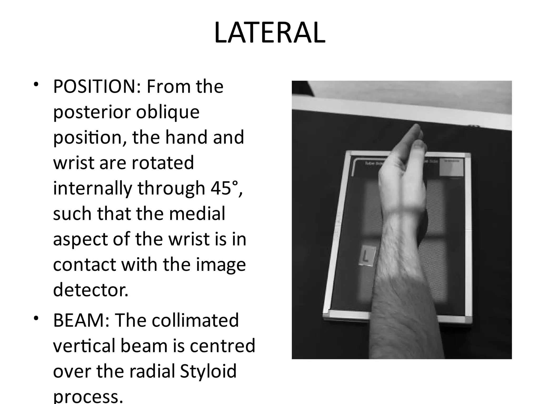 Upper Limb Plain Radiology: DR. MITESH J. PATEL(M.S ORTHO) | PDF