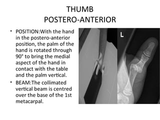 Upper Limb Plain Radiology: DR. MITESH J. PATEL(M.S ORTHO) | PDF