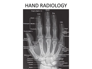 Upper Limb Plain Radiology: DR. MITESH J. PATEL(M.S ORTHO) | PDF