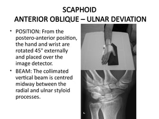 Upper Limb Plain Radiology: DR. MITESH J. PATEL(M.S ORTHO) | PDF