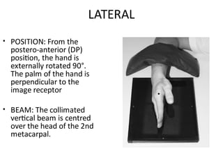 Upper Limb Plain Radiology: DR. MITESH J. PATEL(M.S ORTHO) | PDF