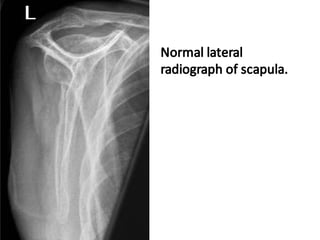 Upper Limb Plain Radiology: DR. MITESH J. PATEL(M.S ORTHO) | PDF