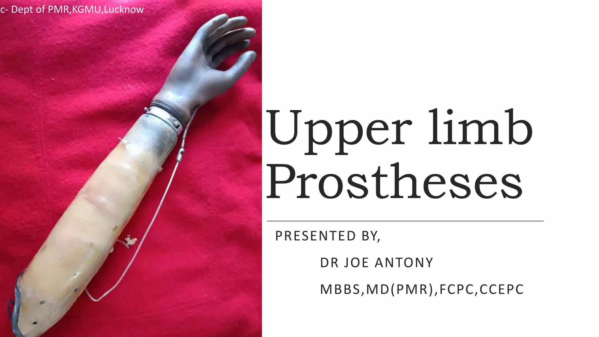 Upper Limb Prostheses PPTX Upper Limb Prostheses PPTX