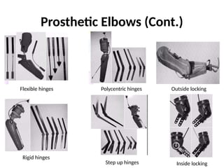 Prosthetic Elbows (Cont.)
Flexible hinges
Rigid hinges
Polycentric hinges
Step up hinges
Outside locking
Inside locking
 