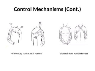 Control Mechanisms (Cont.)
Heavy-Duty Trans Radial Harness Bilateral Trans Radial Harness
 