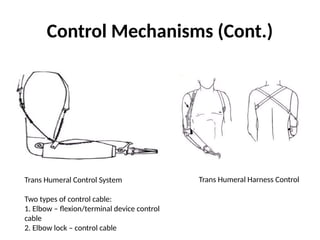 Control Mechanisms (Cont.)
Trans Humeral Control System
Two types of control cable:
1. Elbow – flexion/terminal device control
cable
2. Elbow lock – control cable
Trans Humeral Harness Control
 