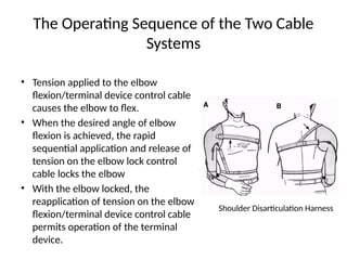 The Operating Sequence of the Two Cable
Systems
• Tension applied to the elbow
flexion/terminal device control cable
causes the elbow to flex.
• When the desired angle of elbow
flexion is achieved, the rapid
sequential application and release of
tension on the elbow lock control
cable locks the elbow
• With the elbow locked, the
reapplication of tension on the elbow
flexion/terminal device control cable
permits operation of the terminal
device.
Shoulder Disarticulation Harness
 