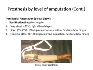 Prosthesis by level of amputation (Cont.)
Trans Radial Amputation (Below Elbow):
• Classification (based on length)
1. Very short (<35%): rigid elbow hinges
2. Short (35-55%): <60 degrees prono-supination, flexible elbow hinges
3. Long (55-90%): 60-120 degrees prono-supination, flexible elbow hinges
Below elbow prosthesis
 