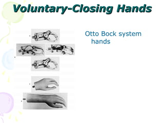 Voluntary-Closing HandsVoluntary-Closing Hands
Otto Bock system
hands
 