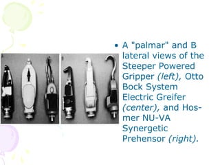 • A "palmar" and B
lateral views of the
Steeper Powered
Gripper (left), Otto
Bock System
Electric Greifer
(center), and Hos-
mer NU-VA
Synergetic
Prehensor (right).
 