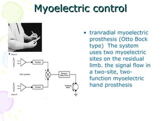 Myoelectric controlMyoelectric control
• tranradial myoelectric
prosthesis (Otto Bock
type) The system
uses two myoelectric
sites on the residual
limb. the signal flow in
a two-site, two-
function myoelectric
hand prosthesis
 