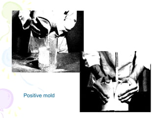 Positive mold
 