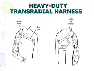 HEAVY-DUTYHEAVY-DUTY
TRANSRADIAL HARNESSTRANSRADIAL HARNESS
 