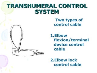 TRANSHUMERAL CONTROLTRANSHUMERAL CONTROL
SYSTEMSYSTEM
Two types of
control cable
1.Elbow
flexion/terminal
device control
cable
2.Elbow lock
control cable
 