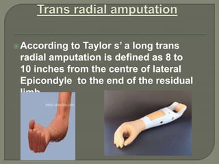 Upper Limb Prosthesis PPTX upper-limb-prosthesis-pptx