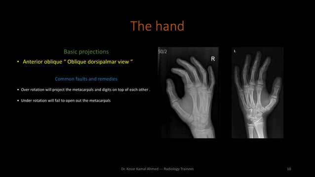 Upper limb radiography | PPTX