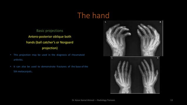 Upper limb radiography | PPTX