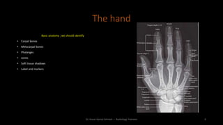 The hand
Basic anatomy ; we should identify
• Carpal bones
• Metacarpal bones
• Phalanges
• Joints
• Soft tissue shadows
• Label and markers
Dr. Kosar Kamal Ahmed --- Radiology Trainees 4
 