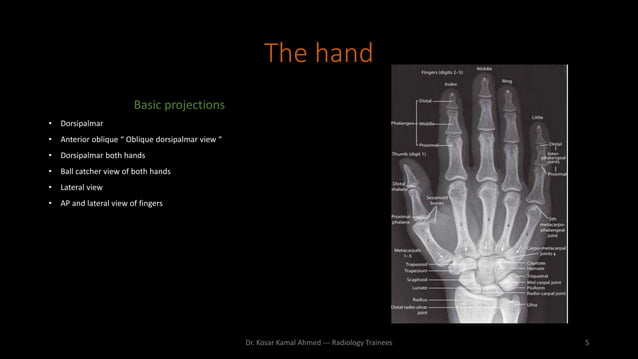 Upper limb radiography | PPTX