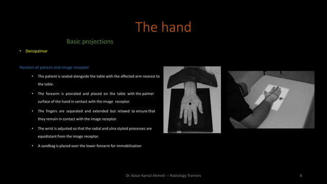 Upper limb radiography | PPTX