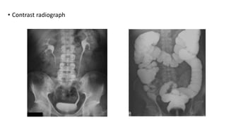 Upper limb radiology | PPTX