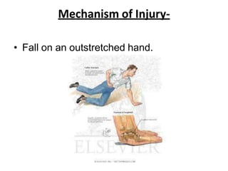 upper limb trauma.pptx