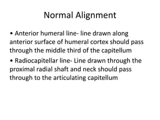 Humelink Alignment upper limb trauma.pptx