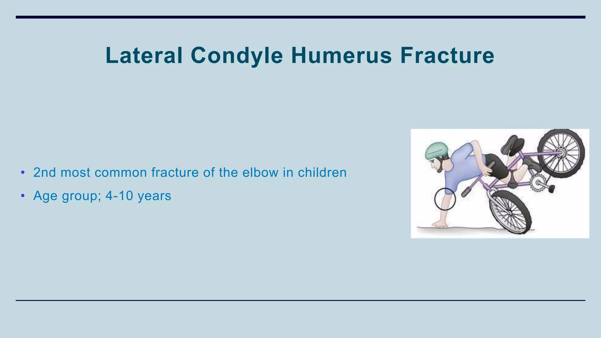 Lateral Condyle Humerus Fracture
• 2nd most common fracture of the elbow in children
• Age group; 4-10 years
 