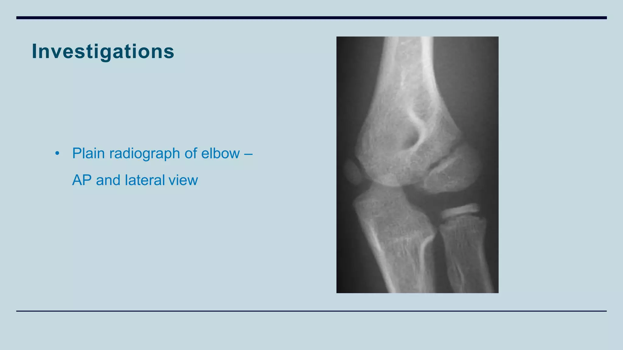 Investigations
• Plain radiograph of elbow –
AP and lateral view
 
