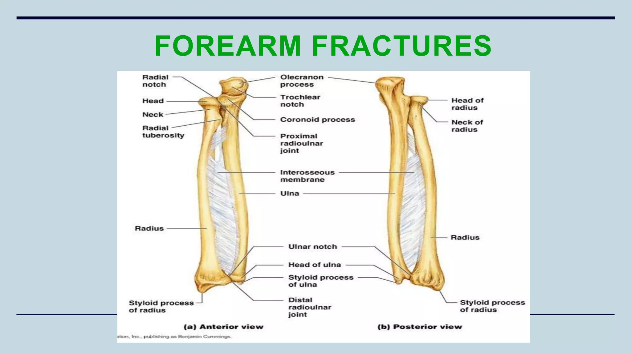 FOREARM FRACTURES
 
