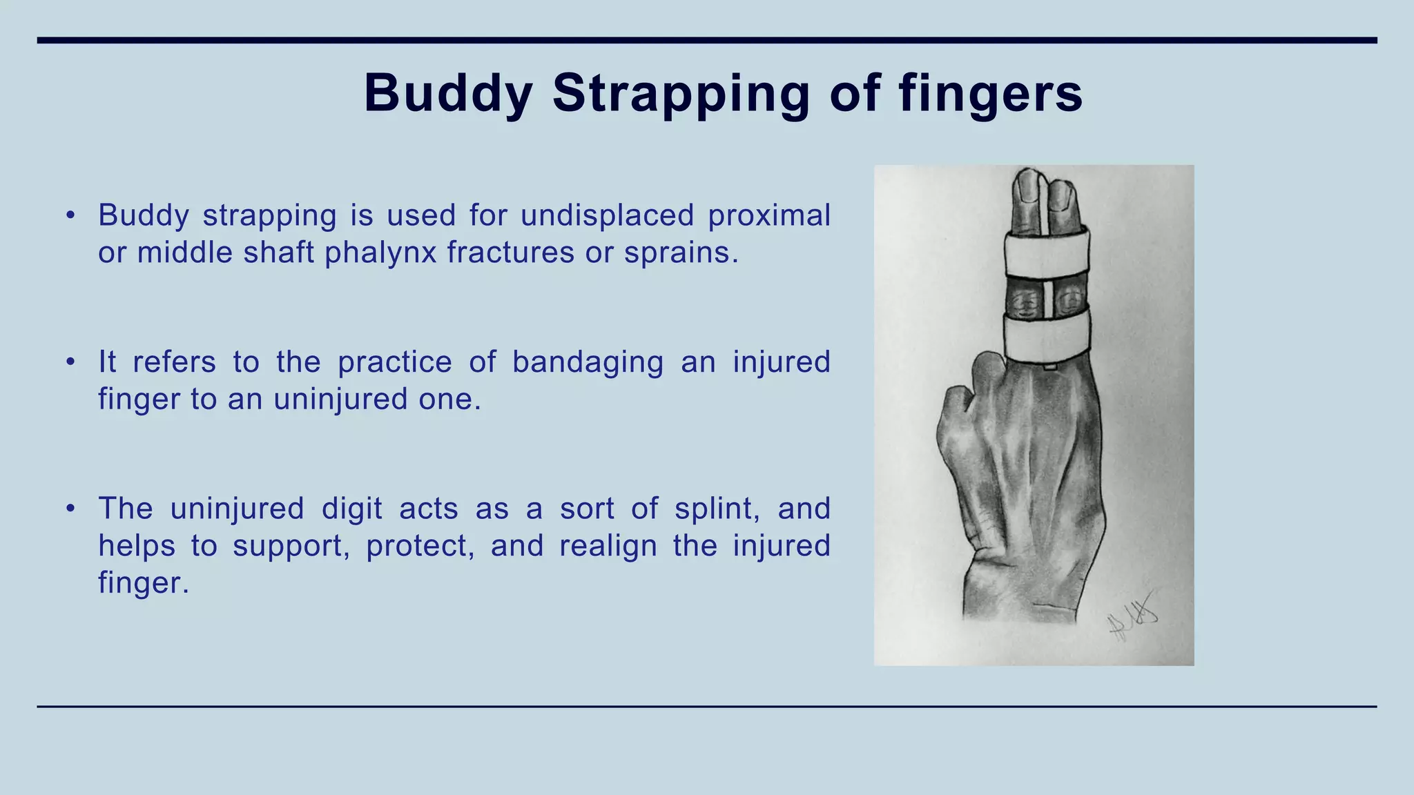 Buddy Strapping of fingers
• Buddy strapping is used for undisplaced proximal
or middle shaft phalynx fractures or sprains.
• It refers to the practice of bandaging an injured
finger to an uninjured one.
• The uninjured digit acts as a sort of splint, and
helps to support, protect, and realign the injured
finger.
 