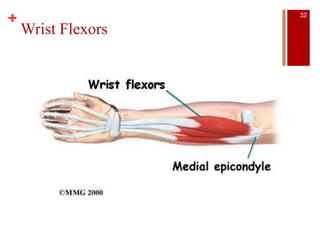 +
Wrist Flexors
32
 