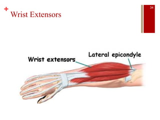 +
Wrist Extensors
34
 