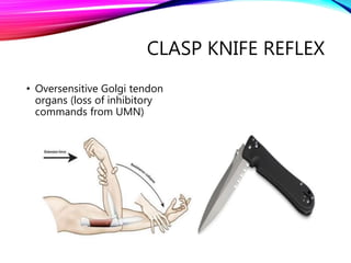 CLASP KNIFE REFLEX
• Oversensitive Golgi tendon
organs (loss of inhibitory
commands from UMN)
 