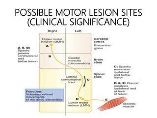 POSSIBLE MOTOR LESION SITES
(CLINICAL SIGNIFICANCE)
 