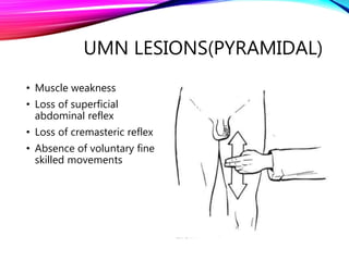 UMN LESIONS(PYRAMIDAL)
• Muscle weakness
• Loss of superficial
abdominal reflex
• Loss of cremasteric reflex
• Absence of voluntary fine
skilled movements
 