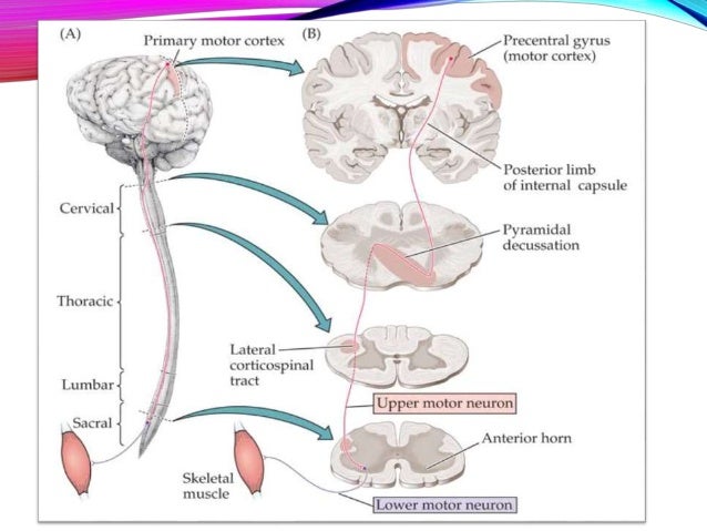 upper motor neuron