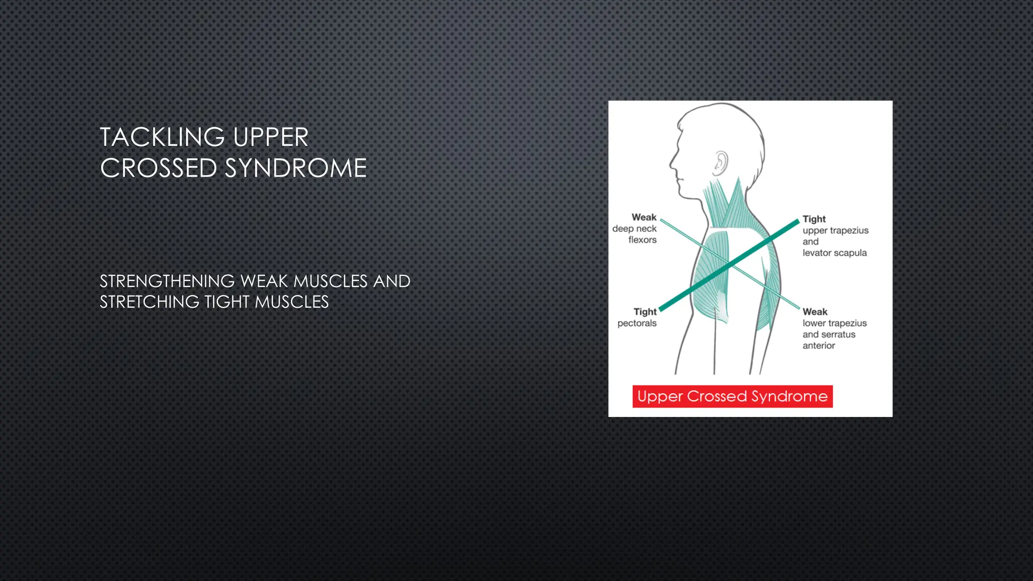 STRENGTHENING WEAK MUSCLES AND
STRETCHING TIGHT MUSCLES
TACKLING UPPER
CROSSED SYNDROME
 