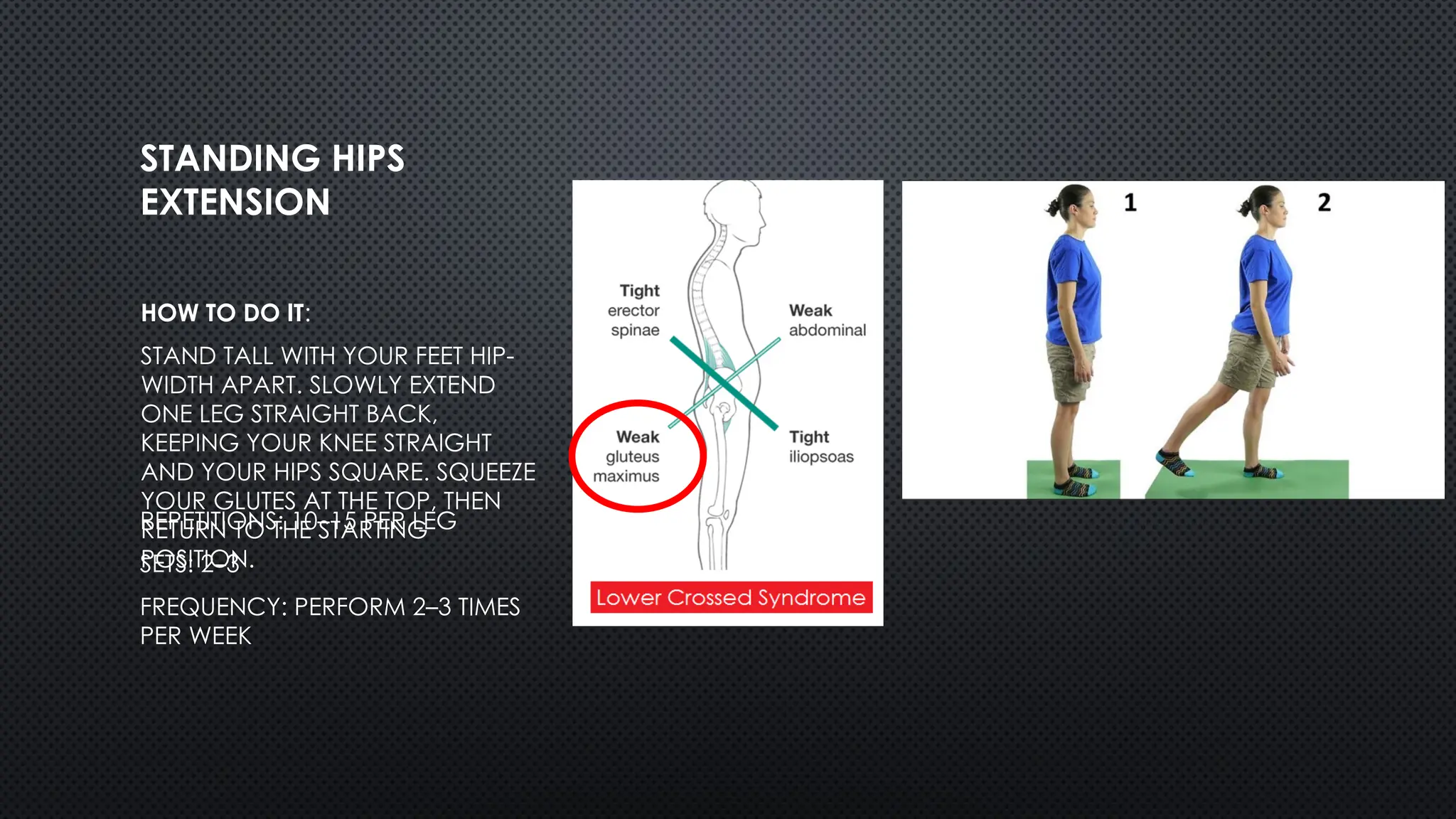 STANDING HIPS
EXTENSION
HOW TO DO IT:
STAND TALL WITH YOUR FEET HIP-
WIDTH APART. SLOWLY EXTEND
ONE LEG STRAIGHT BACK,
KEEPING YOUR KNEE STRAIGHT
AND YOUR HIPS SQUARE. SQUEEZE
YOUR GLUTES AT THE TOP, THEN
RETURN TO THE STARTING
POSITION.
REPETITIONS: 10–15 PER LEG
SETS: 2–3
FREQUENCY: PERFORM 2–3 TIMES
PER WEEK
 