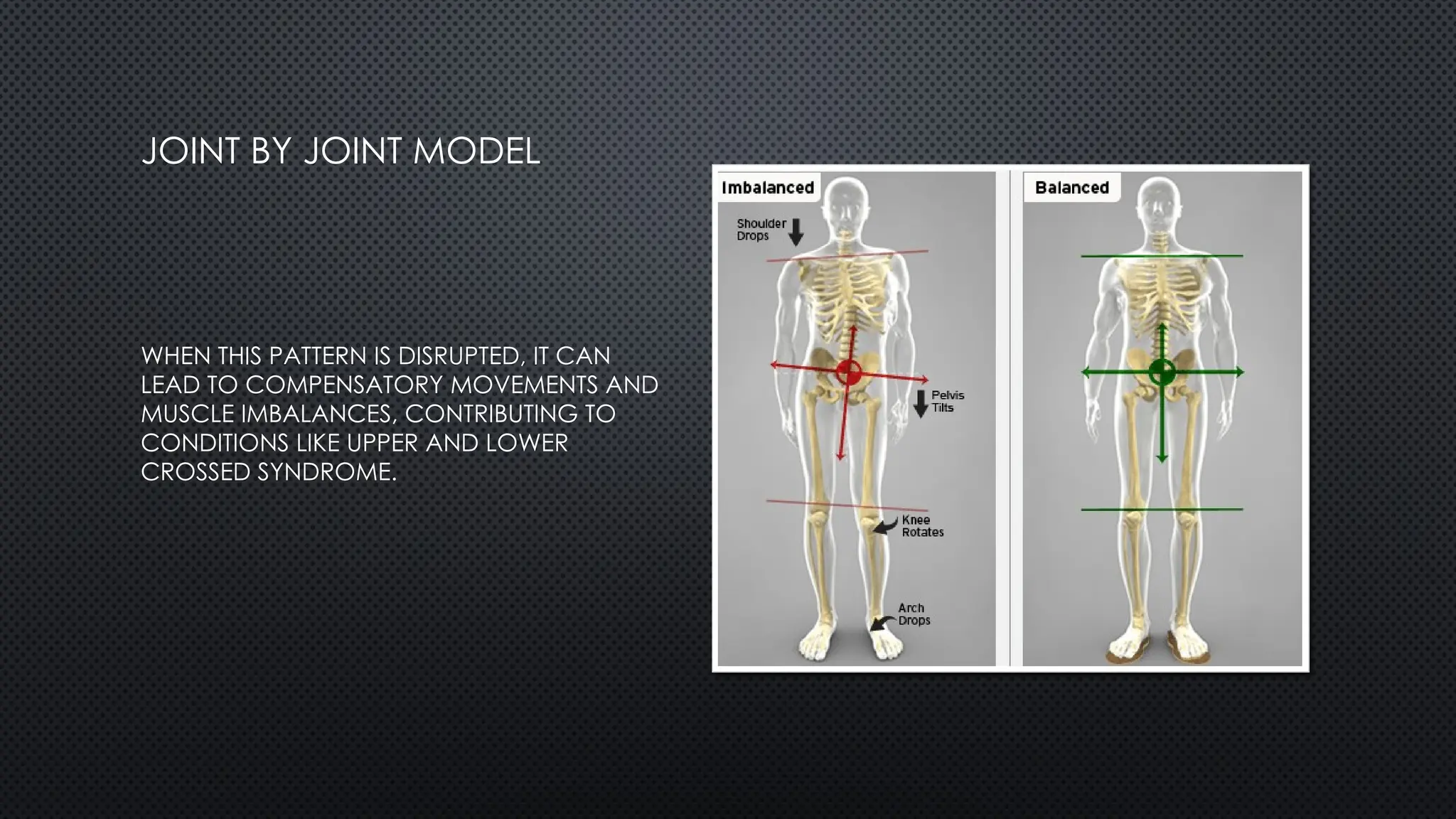 JOINT BY JOINT MODEL
WHEN THIS PATTERN IS DISRUPTED, IT CAN
LEAD TO COMPENSATORY MOVEMENTS AND
MUSCLE IMBALANCES, CONTRIBUTING TO
CONDITIONS LIKE UPPER AND LOWER
CROSSED SYNDROME.
 